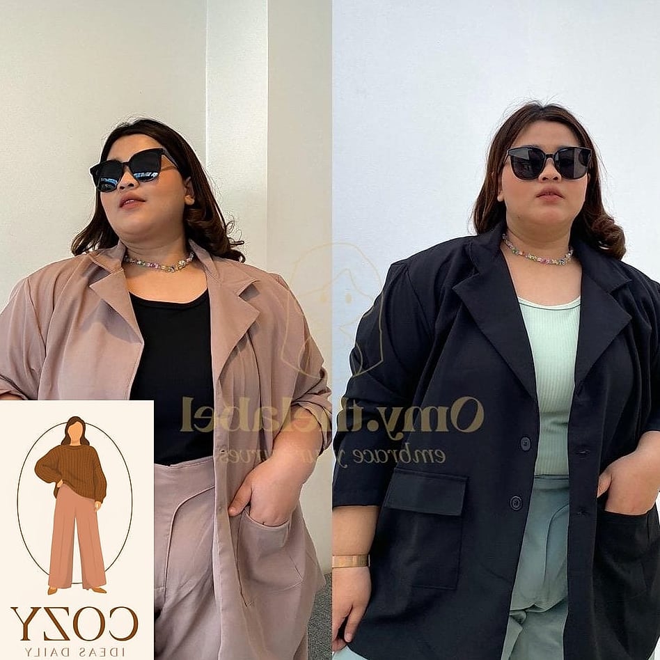 The Oversized Blazer Over a Simple Dress