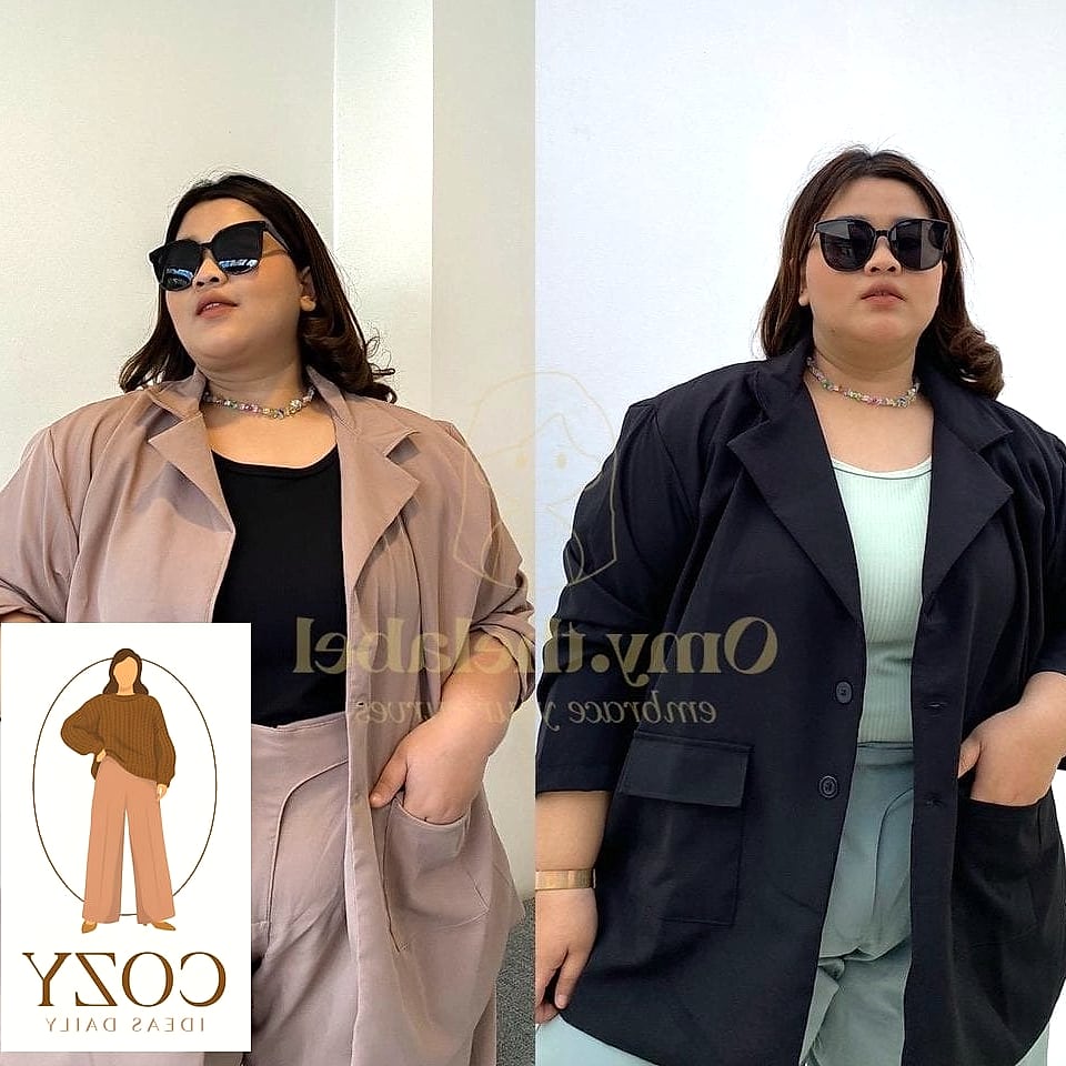 Oversized Blazer as a Dress
